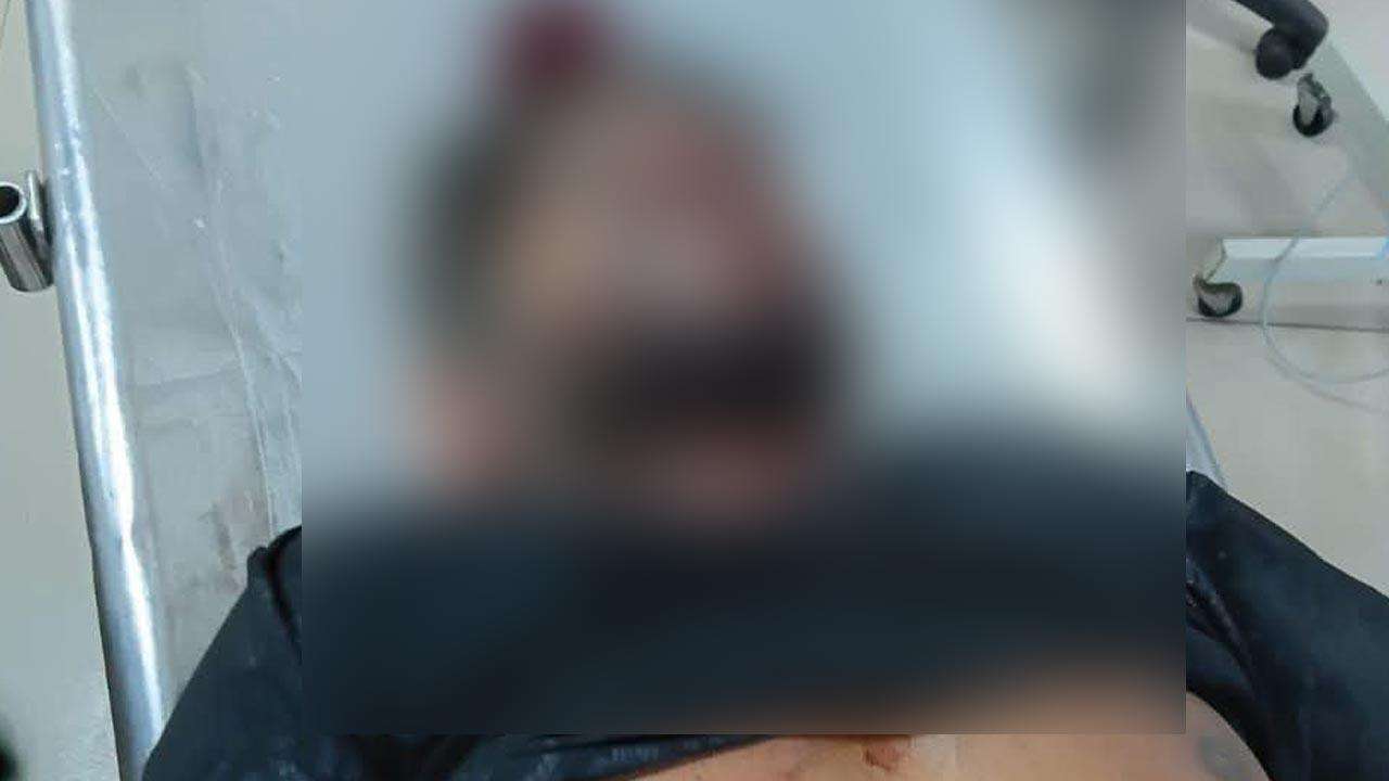 பயாகல துப்பாக்கிச் சூட்டில் காயமடைந்தவர் உயிரிழப்பு