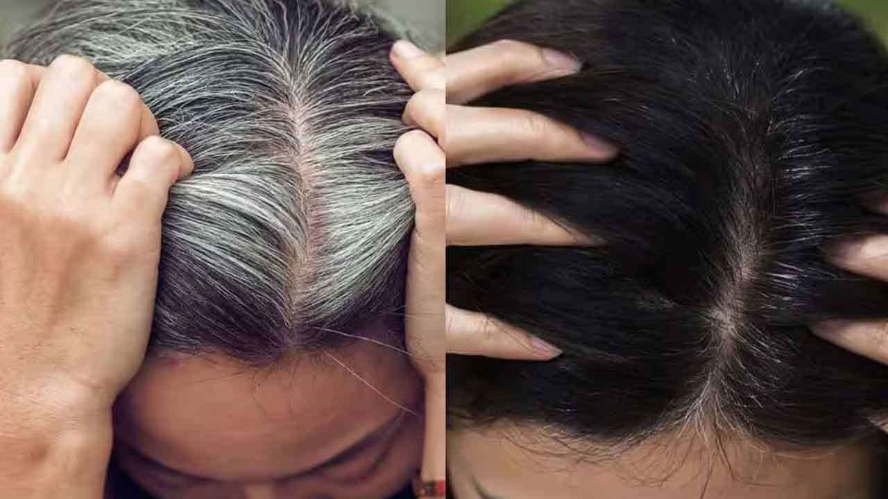இளநரையை போக்கும் எளிய வழிகள்