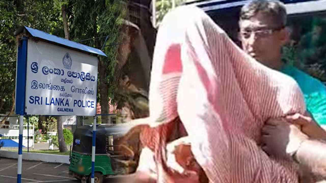 அனுராதபுரம் வைத்தியர் விவகாரம் - சந்தேகநபரின் சகோதரி கைது