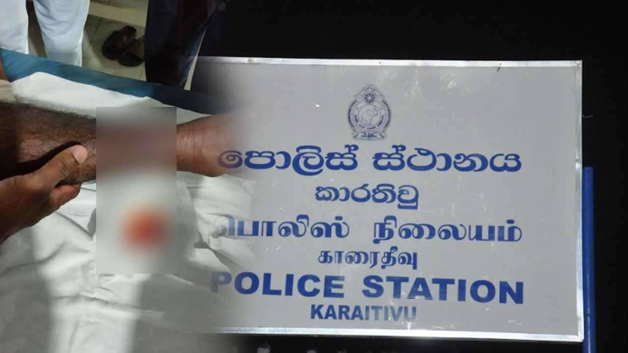 துப்பாக்கி வெடித்ததில் பொலிஸ் அதிகாரி காயம்