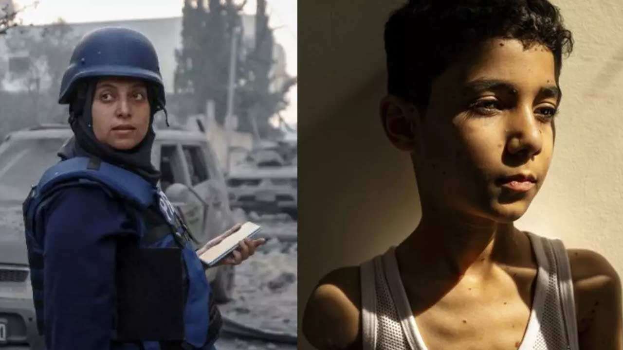 இஸ்ரேல் தாக்குதலில் கைகளை இழந்த 9 வயது காசா சிறுவனின் புகைப்படம்!