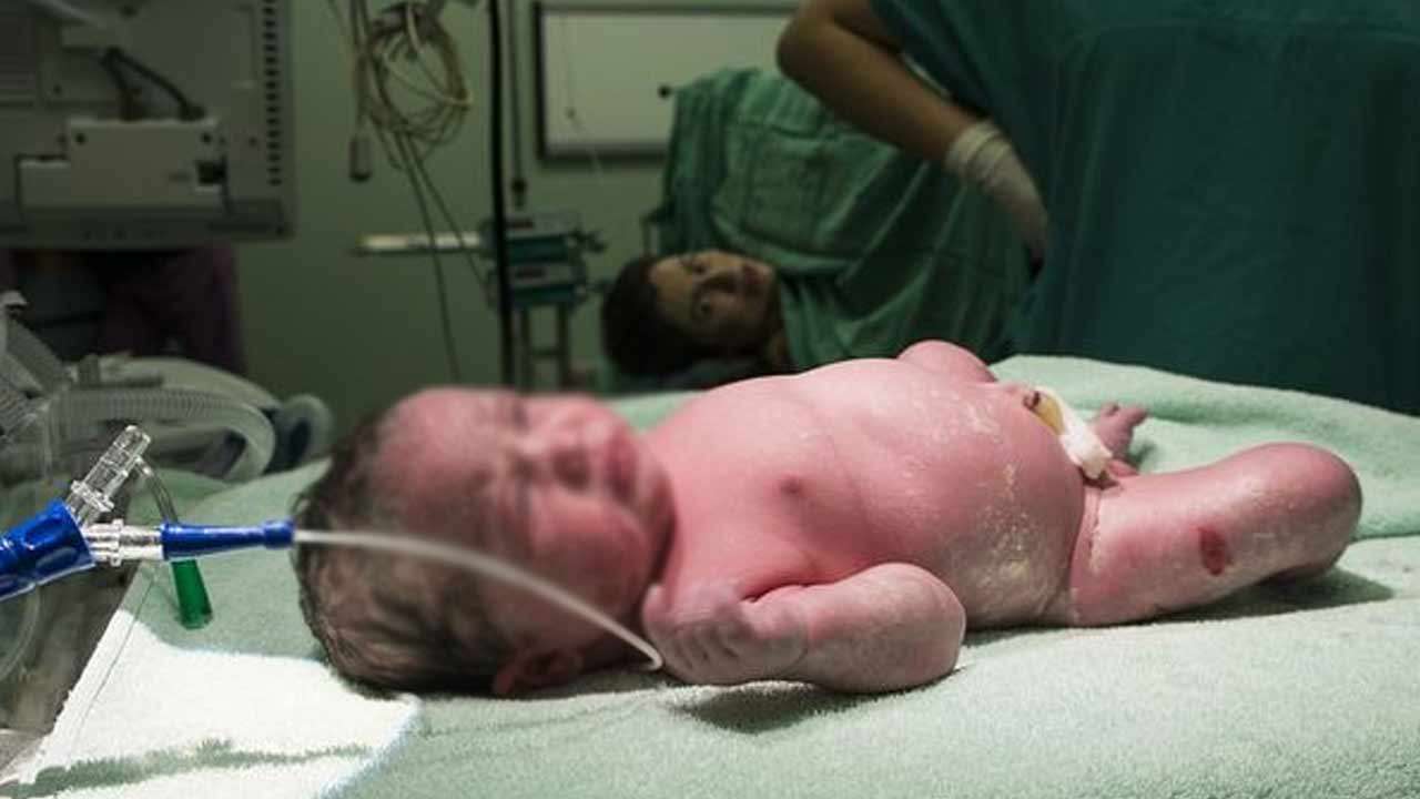 ஒரே குழந்தை இருமுறை பிறந்த அதிசயம்!