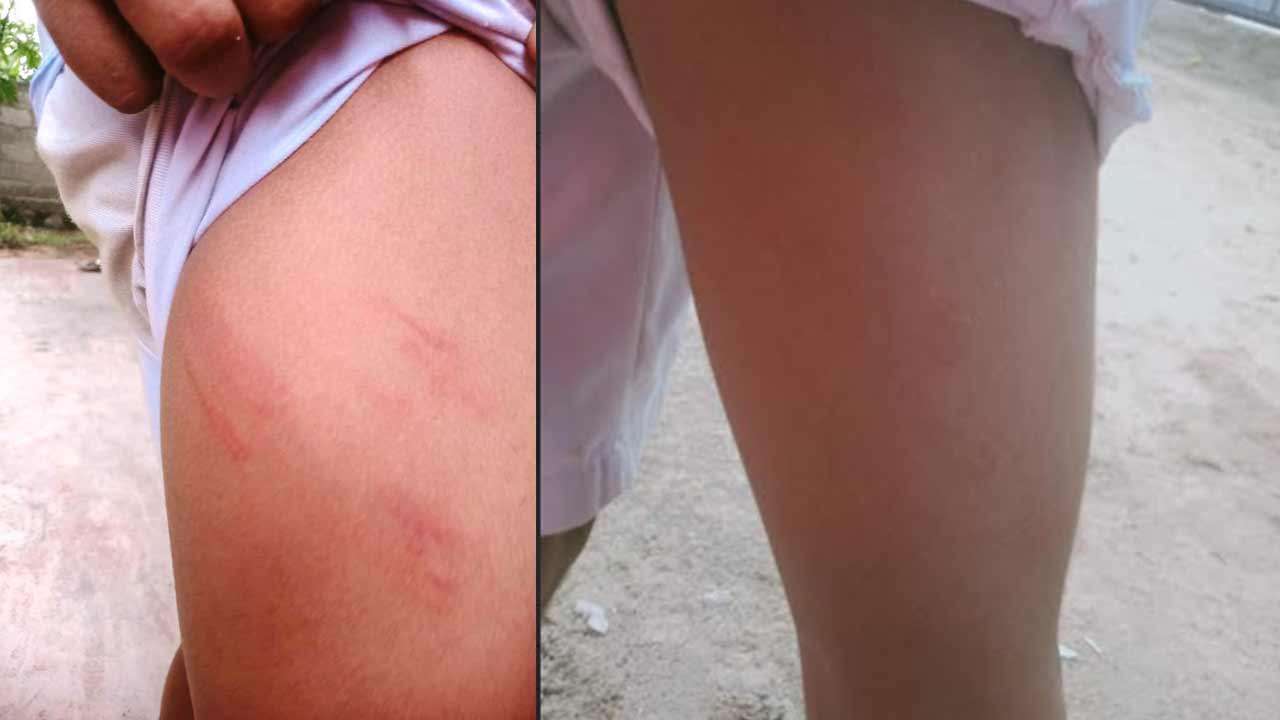 9 மாணவர்களை கொடூரமாக தாக்கிய அதிபர்