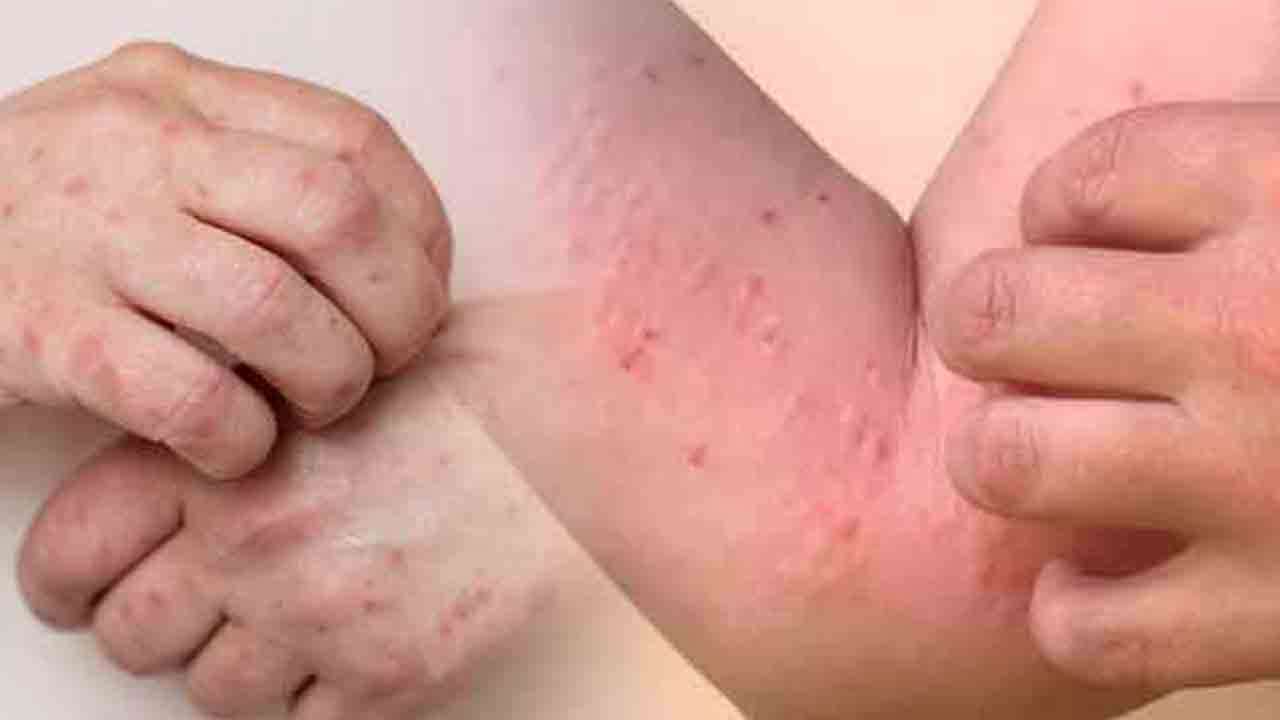 குழந்தைகளிடையே  வேகமாக பரவும் நோய்கள்!