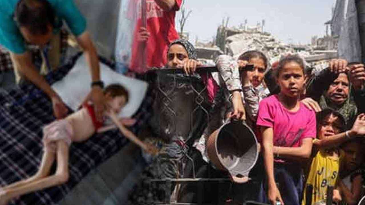 காசாவில் ஊட்டச்சத்து குறைபாட்டால் உயிரிழந்துவரும் குழந்தைகள்