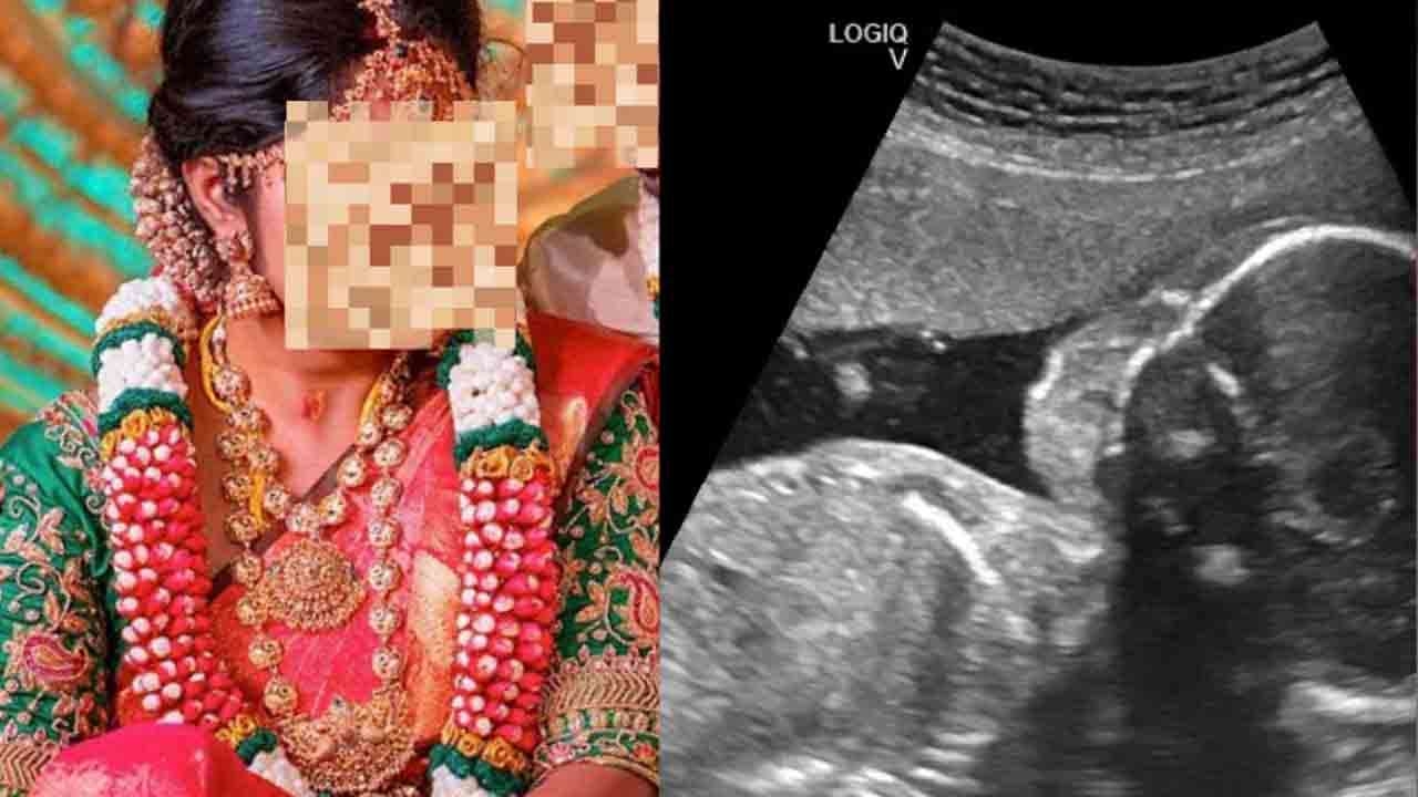SCAN செய்த மருத்துவர் - அதிர்ச்சியில் உறைந்த கணவன்