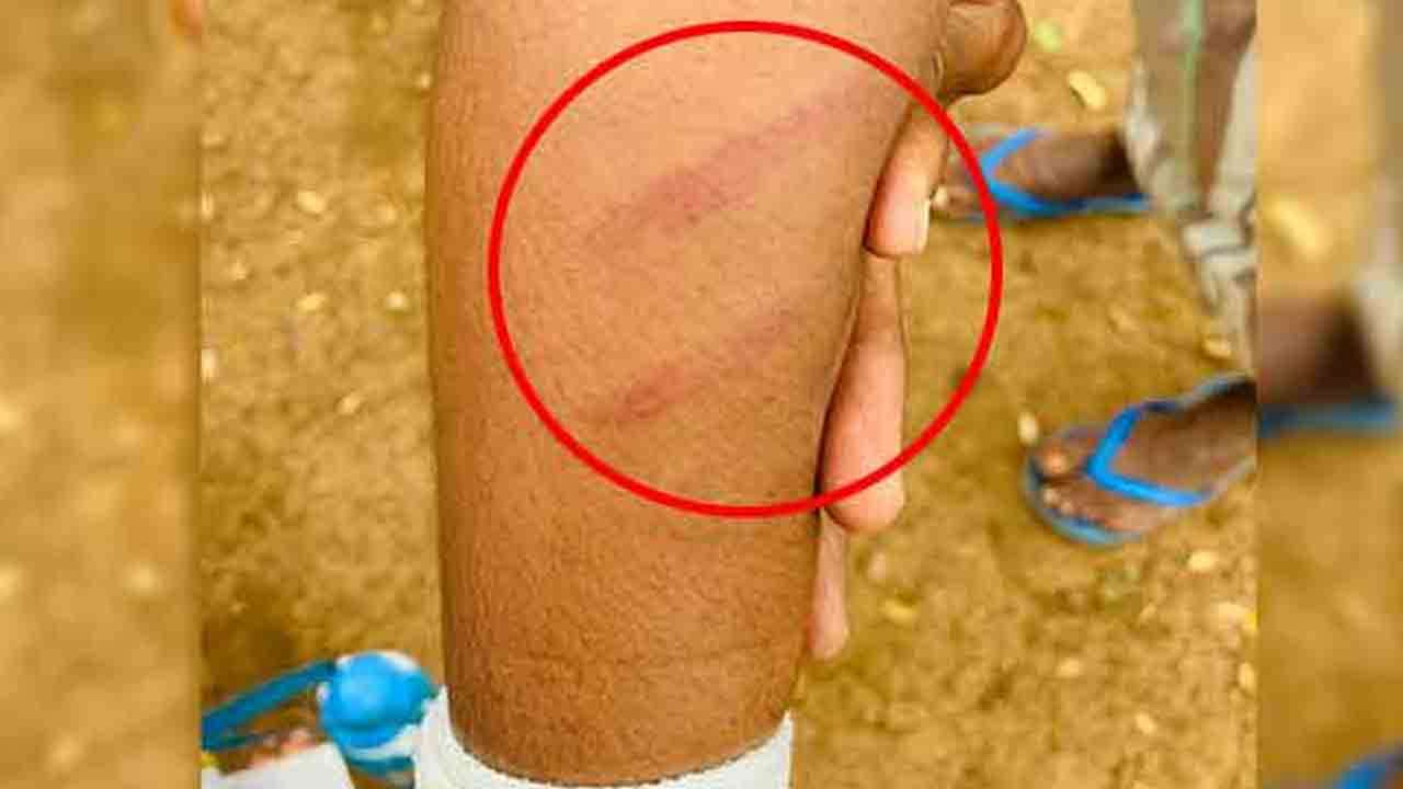இரண்டாம் தர மாணவிக்கு அதிபர் வழங்கிய கொடூரத் தண்டனை