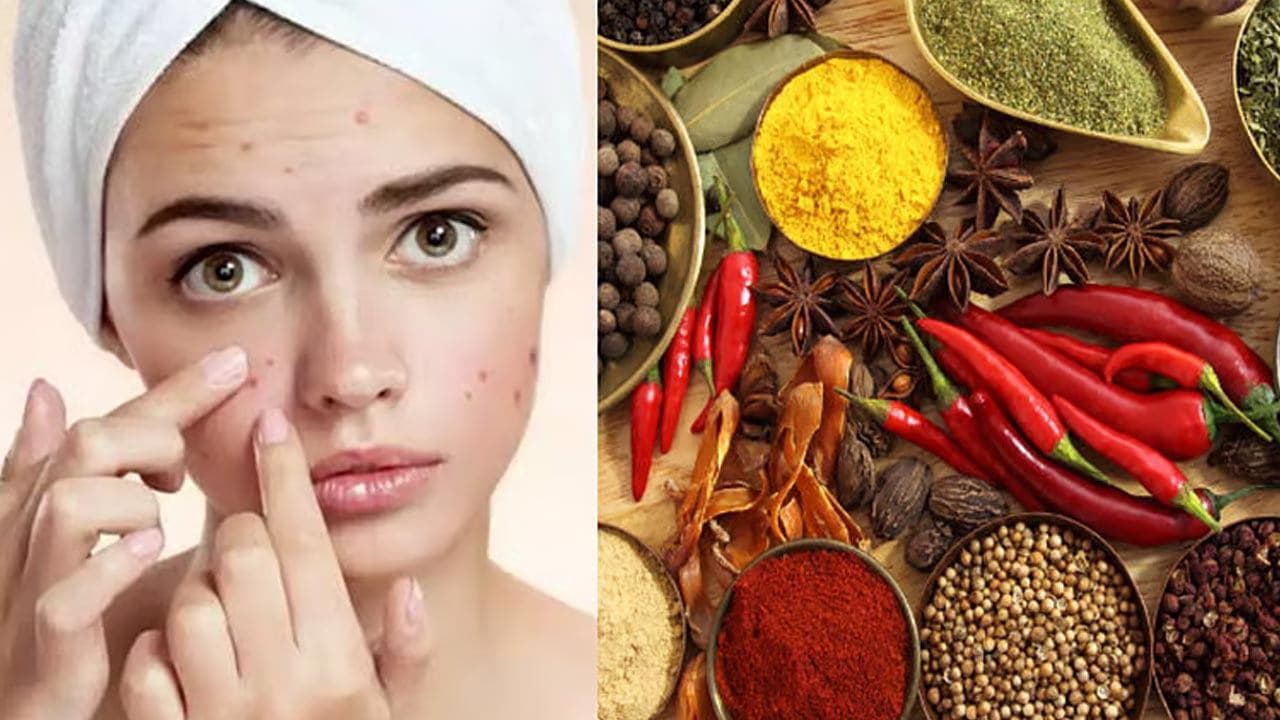 முகப்பருக்களைத் தூண்டும் உணவுகள்!