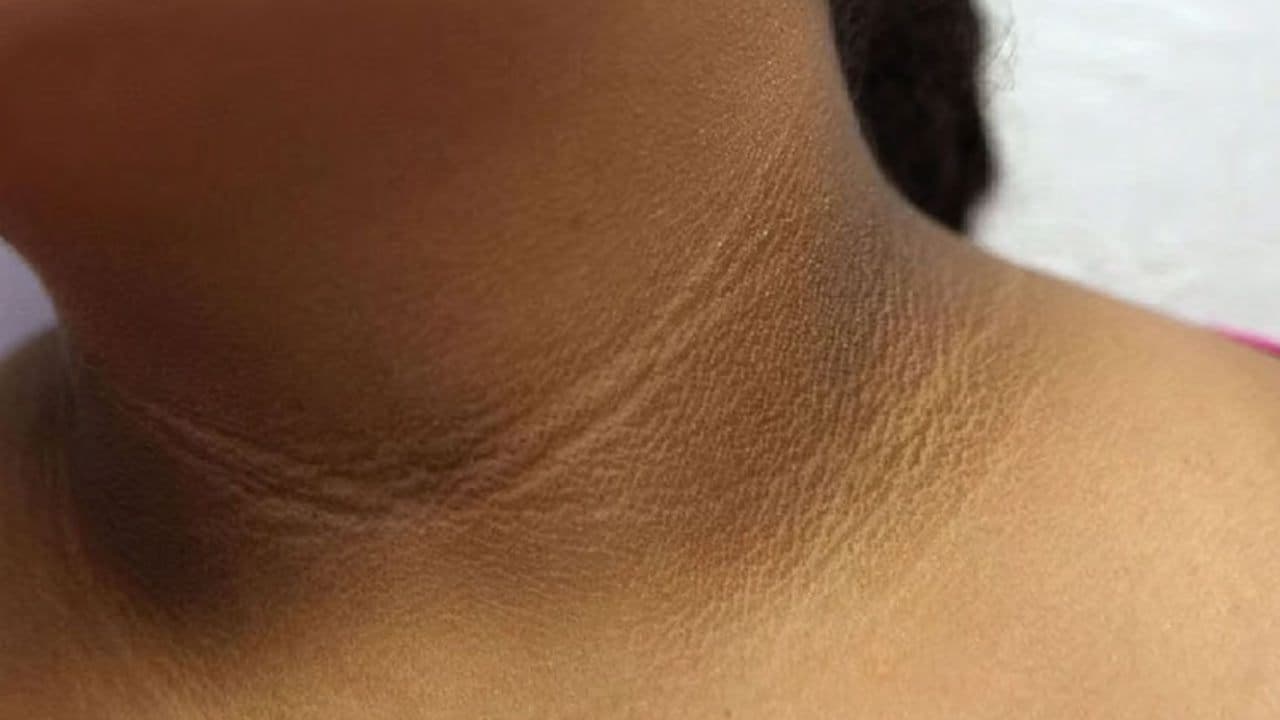 கழுத்துல கருப்பா இருக்கா?