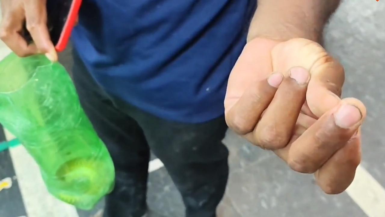தன்னை கடித்த பாம்புடன் சிகிச்சைக்கு வந்த இளைஞர்!